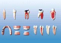 牙齿病变系列模型